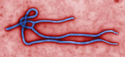 Ebola, le coût de la maladie Ebola, le coût de la maladie